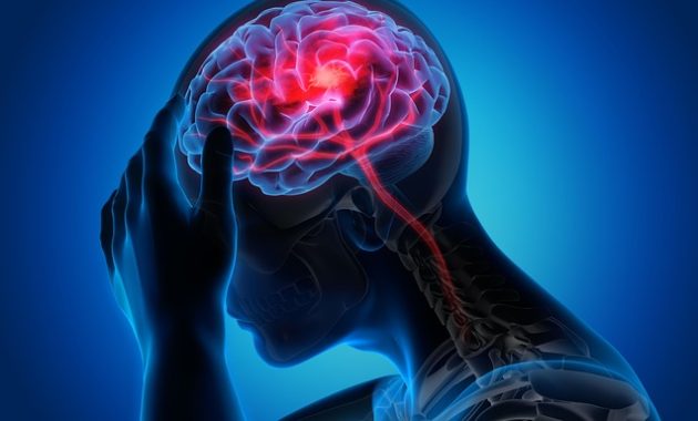 Inilah Makanan yang Memicu Migraine dan Tips Mengatasinya